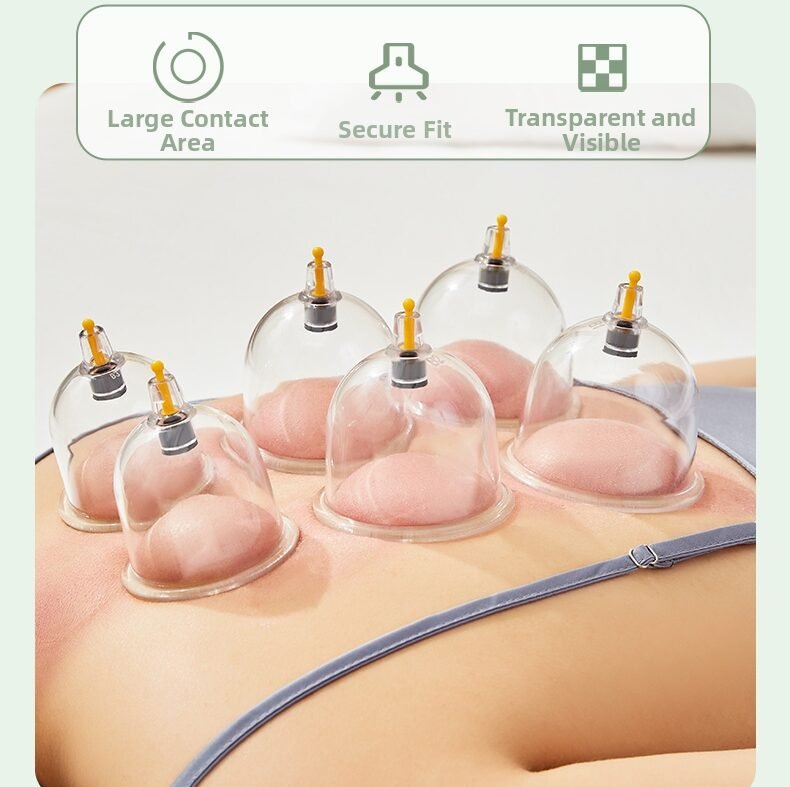 TCM Vacuum Cupping Set (Non-Glass) - Household & Medical Pump-Action Device for Dampness Removal